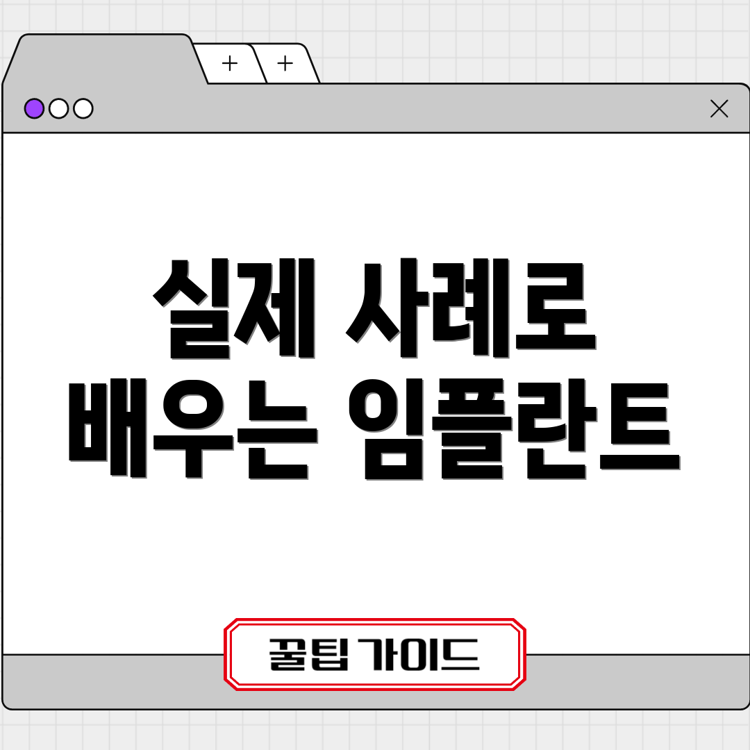 실제 사례로 배우는 임플란트